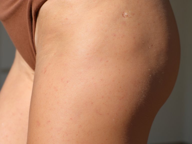 Avoiding Itch and Chafing in Long-Term Wear